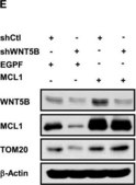 Anti-WNT5B antibody produced in rabbit affinity isolated antibody, buffered aqueous solution