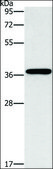 Anti-MARC1 antibody produced in rabbit affinity isolated antibody