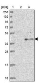 Anti-TCTN1 antibody produced in rabbit Prestige Antibodies® Powered by Atlas Antibodies, affinity isolated antibody, buffered aqueous glycerol solution