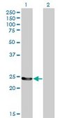 Monoclonal Anti-GSTM4 antibody produced in mouse clone 4B4, purified immunoglobulin, buffered aqueous solution