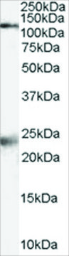 Anti-NMDA Receptor 1/GRIN1 antibody produced in goat affinity isolated antibody, buffered aqueous solution