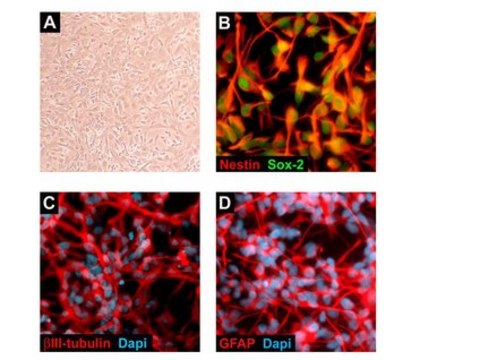 ReNcell CX人神经祖细胞系 ReNcell CX is an immortalized human neural progenitor cell line with the ability to readily differentiate into neurons &amp; glial cells.