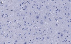 Anti-NMDAR2B Antibody, clone 5C18 ZooMAb® Rabbit Monoclonal recombinant, expressed in HEK 293 cells