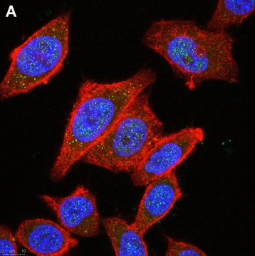 Anti-HDAC4 Antibody, clone 1C16 ZooMAb&#174; Rabbit Monoclonal recombinant, expressed in HEK 293 cells