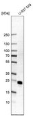Anti-PARK7 antibody produced in rabbit affinity isolated antibody, buffered aqueous glycerol solution