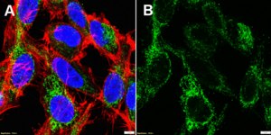 Anti-CPT1A Antibody, clone 2N14 ZooMAb® Rabbit Monoclonal recombinant, expressed in HEK 293 cells