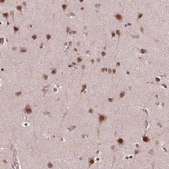 Anti-NFAT5 antibody produced in rabbit Prestige Antibodies® Powered by Atlas Antibodies, affinity isolated antibody, buffered aqueous glycerol solution