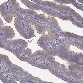 Anti-SPAG17 antibody produced in rabbit Prestige Antibodies® Powered by Atlas Antibodies, affinity isolated antibody, buffered aqueous glycerol solution, ab1