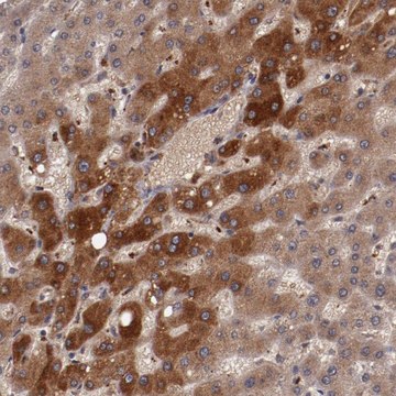 Anti-CP antibody produced in rabbit Prestige Antibodies&#174; Powered by Atlas Antibodies, affinity isolated antibody, buffered aqueous glycerol solution