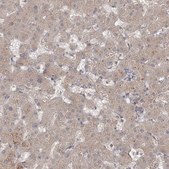 Anti-MPP7 antibody produced in rabbit Prestige Antibodies® Powered by Atlas Antibodies, affinity isolated antibody, buffered aqueous glycerol solution
