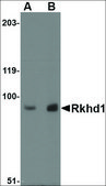 Anti-RKHD1 antibody produced in rabbit affinity isolated antibody, buffered aqueous solution