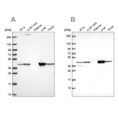 Anti-GOT1 antibody produced in rabbit Prestige Antibodies® Powered by Atlas Antibodies, affinity isolated antibody