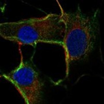 Anti-ZDHHC2 antibody produced in rabbit Prestige Antibodies&#174; Powered by Atlas Antibodies, affinity isolated antibody, buffered aqueous glycerol solution