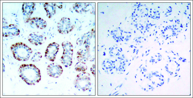 抗 BCL2L11 (Ab-69) 兔抗 affinity isolated antibody