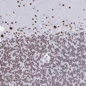 Anti-SIRT7 antibody produced in rabbit Prestige Antibodies® Powered by Atlas Antibodies, affinity isolated antibody, buffered aqueous glycerol solution