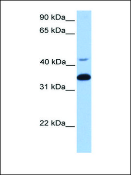 Anti-GNB2 antibody produced in rabbit affinity isolated antibody