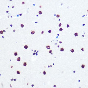 Anti-PN1 antibody produced in rabbit