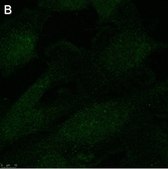 Anti-p62/SQSTM1 Antibody, clone 2D14 ZooMAb® Rabbit Monoclonal recombinant, expressed in HEK 293 cells