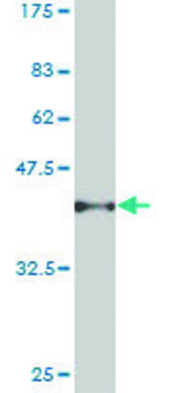 ANTI-PSPH antibody produced in mouse clone 3C1, purified immunoglobulin, buffered aqueous solution