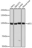 Anti-eEF2 Antibody, clone 4E2Z5, Rabbit Monoclonal