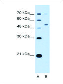 Anti-CDR2 antibody produced in rabbit IgG fraction of antiserum