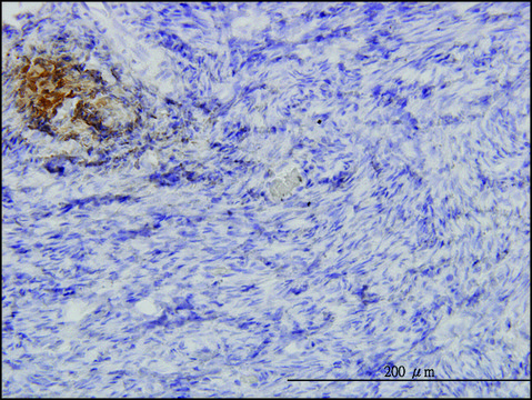 Monoclonal Anti-ANGPTL1 antibody produced in mouse clone 3A5, purified immunoglobulin, buffered aqueous solution