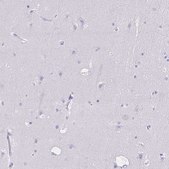 Anti-NCF1 antibody produced in rabbit Prestige Antibodies® Powered by Atlas Antibodies, affinity isolated antibody, buffered aqueous glycerol solution