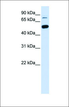 Anti-SMARCD1 antibody produced in rabbit affinity isolated antibody