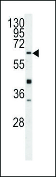 ANTI-GGTLA1(N-TERMINAL) antibody produced in rabbit purified immunoglobulin, buffered aqueous solution