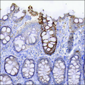 Anti-FRMD6 antibody produced in rabbit Prestige Antibodies® Powered by Atlas Antibodies, affinity isolated antibody, buffered aqueous glycerol solution