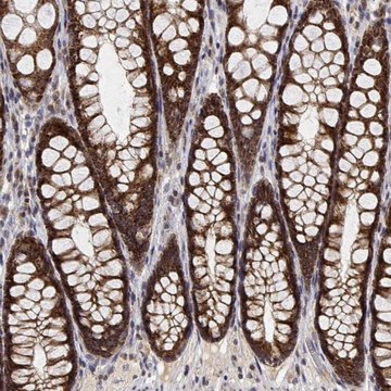 Anti-GADD45GIP1 antibody produced in rabbit Prestige Antibodies&#174; Powered by Atlas Antibodies, affinity isolated antibody, buffered aqueous glycerol solution