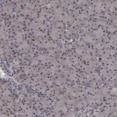 Anti-SAE1 antibody produced in rabbit Prestige Antibodies® Powered by Atlas Antibodies, affinity isolated antibody, buffered aqueous glycerol solution
