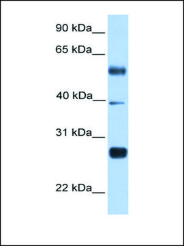 Anti-MXD3 antibody produced in rabbit affinity isolated antibody