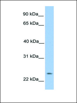 Anti-ORAI1 (AB1) antibody produced in rabbit affinity isolated antibody