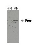 Anti-PREP antibody produced in rabbit affinity isolated antibody