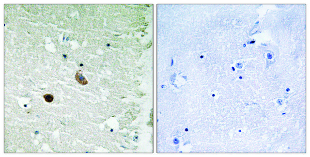 Anti-CAMK2 antibody produced in rabbit affinity isolated antibody