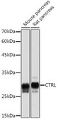 Anti-CTRL antibody produced in rabbit