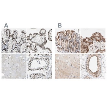 Anti-GATAD2A antibody produced in rabbit Prestige Antibodies&#174; Powered by Atlas Antibodies, affinity isolated antibody, buffered aqueous glycerol solution