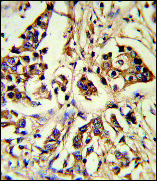 ANTI-ARHGAP18 (CENTER) antibody produced in rabbit IgG fraction of antiserum, buffered aqueous solution