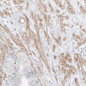 Anti-ITPKB antibody produced in rabbit Prestige Antibodies® Powered by Atlas Antibodies, affinity isolated antibody, buffered aqueous glycerol solution