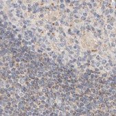 Anti-HDHD3 antibody produced in rabbit Prestige Antibodies® Powered by Atlas Antibodies, affinity isolated antibody, buffered aqueous glycerol solution, Ab3