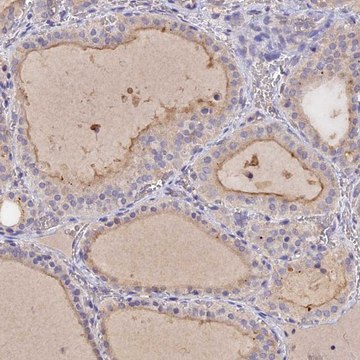 Anti-SLC26A4 antibody produced in rabbit Prestige Antibodies&#174; Powered by Atlas Antibodies, affinity isolated antibody, buffered aqueous glycerol solution