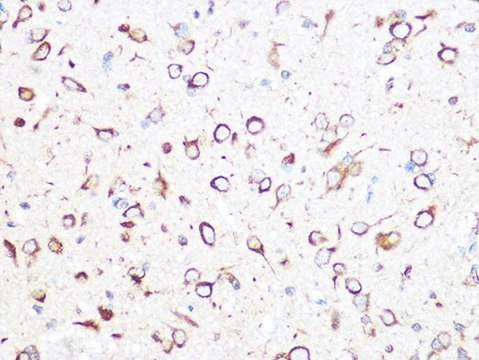 Anti-TCP1 beta/CCT2 antibody produced in rabbit