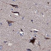 Anti-CLPB antibody produced in rabbit Prestige Antibodies® Powered by Atlas Antibodies, affinity isolated antibody, buffered aqueous glycerol solution