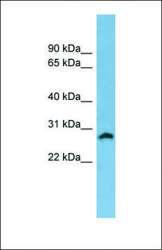 Anti-SRD5A2, (N-terminal) antibody produced in rabbit affinity isolated antibody