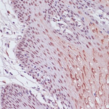 Anti- KDM1 antibody produced in rabbit