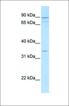 Anti-TNMD (ab1) antibody produced in rabbit affinity isolated antibody