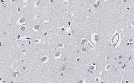 Anti-α-Synuclein Antibody, clone 2F12 ZooMAb® Mouse Monoclonal recombinant, expressed in HEK 293 cells