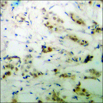 Anti-phospho-p53 (pSer20) antibody produced in rabbit affinity isolated antibody