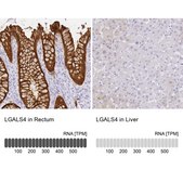 Anti-LGALS4 antibody produced in rabbit Prestige Antibodies® Powered by Atlas Antibodies, affinity isolated antibody, buffered aqueous glycerol solution